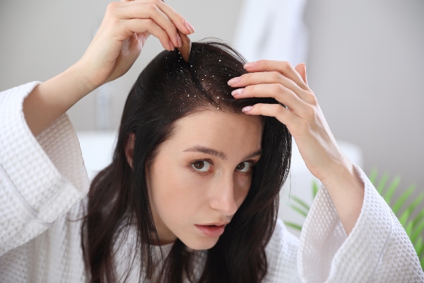Concept per dermatite seborroica ai capelli - Più Medical