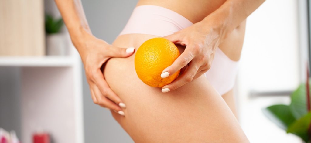 Concept per creme anticellulite: donna con arancia in mano accanto al gluteo - Più Medical