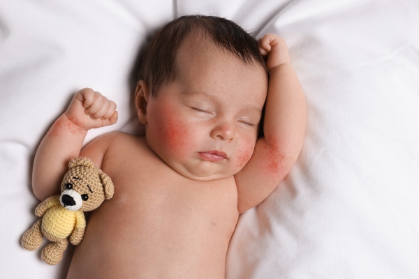 Concept per cura della pelle del neonato e del bambino - Più Medical