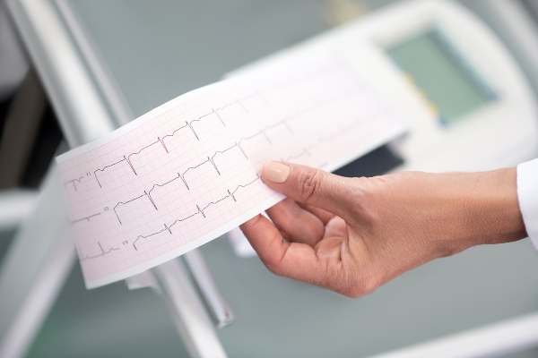 Close up di una mano che tiene il tracciato di un elettrocardiogramma 