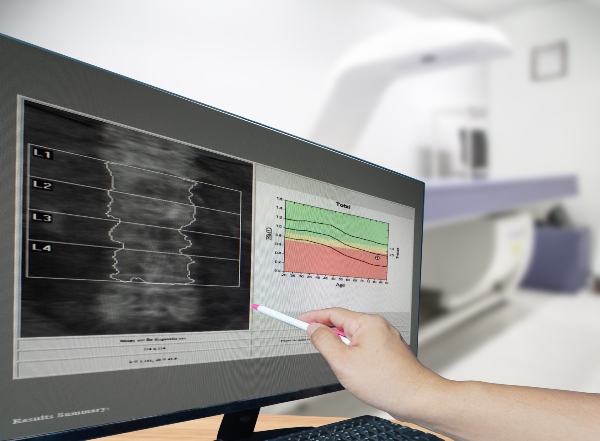 Concept per densitometria ossea: risultati sullo schermo di un computer- Più Medical